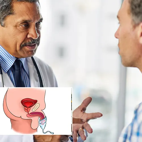 The Different Types of Penile Implants and Choosing the Right One
