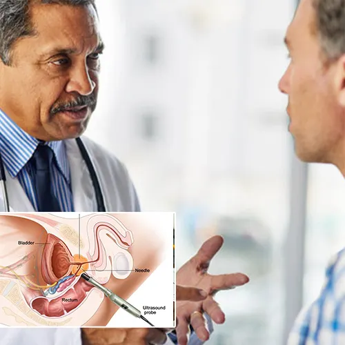Effective Exercises for Penile Implant Recovery